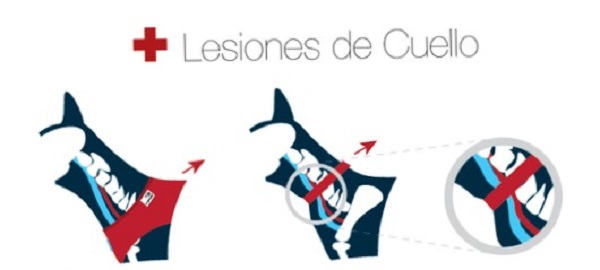Órganos como la tiroides, la tráquea, laringe o esófago se ubican en el cuello del animal; la presión sobre ellas pude ocasionar desde atragantamientos hasta lesiones más serias.
